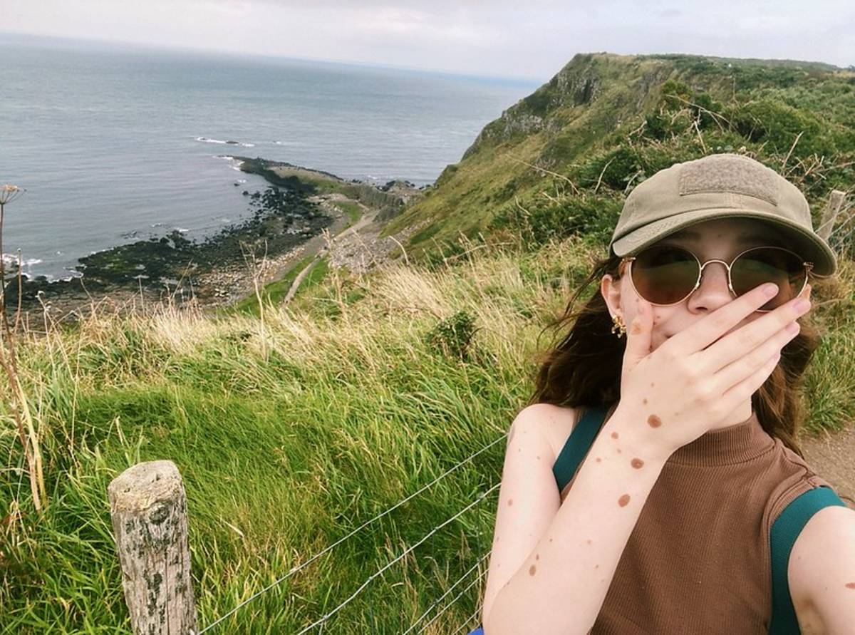 Study in Ireland with Greenheart Travel
